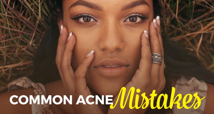 Common Mistakes People With Acne Commit That Make Their Condition Worse