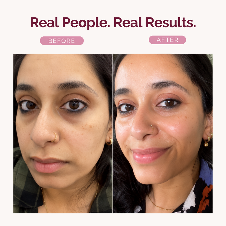 Before and after facial comparison of a woman, with the headline 'Real People. Real Results.